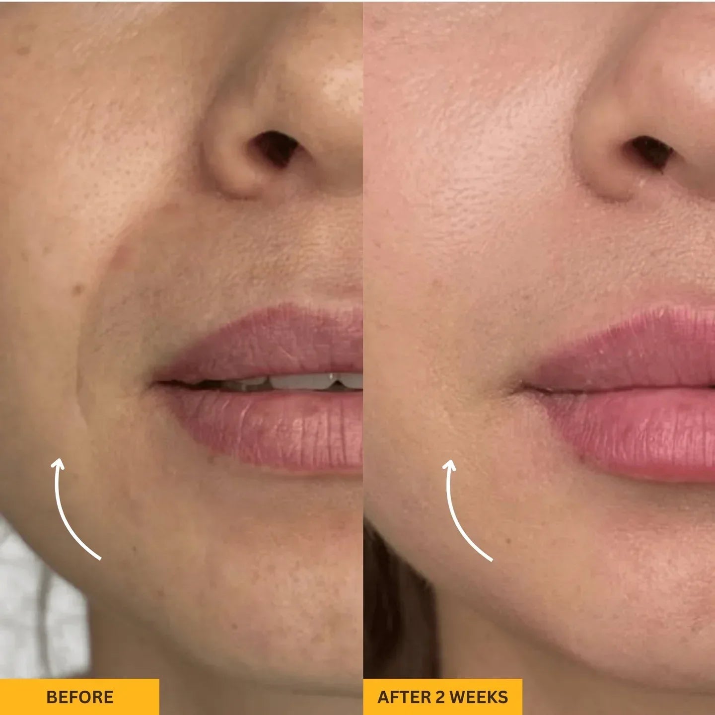 Gua Sha Brush for Snatched Face
