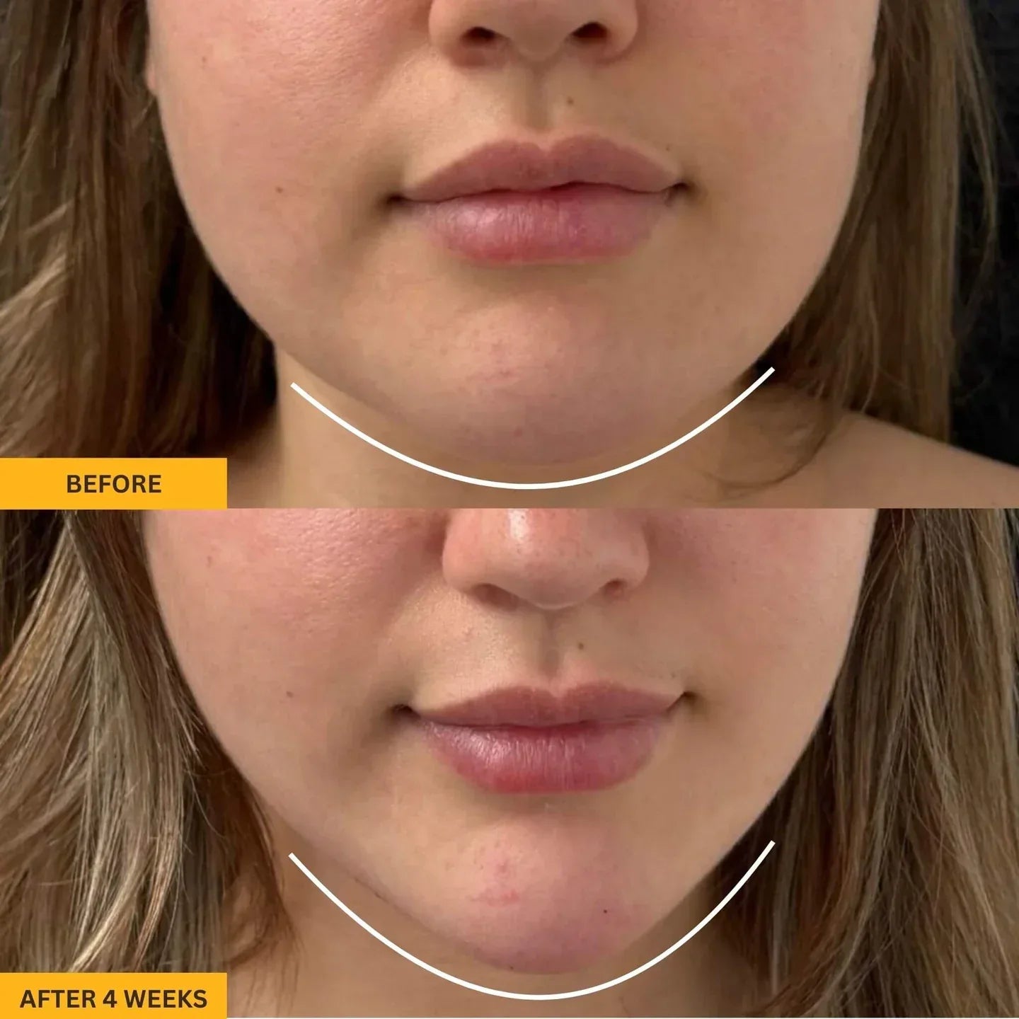 Gua Sha Brush for Snatched Face